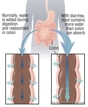Unmasking the Fluid Crisis: Which Organ Is Affected by Diarrhea When Everything Goes Wrong?