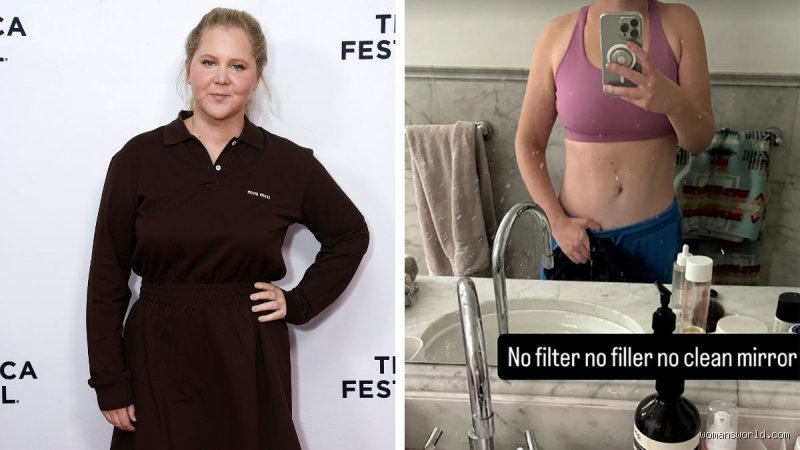 Why Did Amy Schumer Stop Taking Ozempic? The Real Reason Behind Her Hollywood Weight Loss Departure
