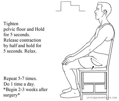 How to sit after prostate surgery: Master the delicate recovery rules for better healing
