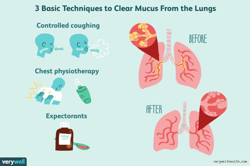How to get toxic fumes out of your lungs?