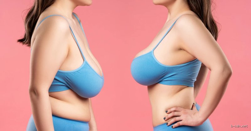The Deflated Truth: What are Ozempic Breasts and Why Rapid Weight Loss Changes Your Anatomy