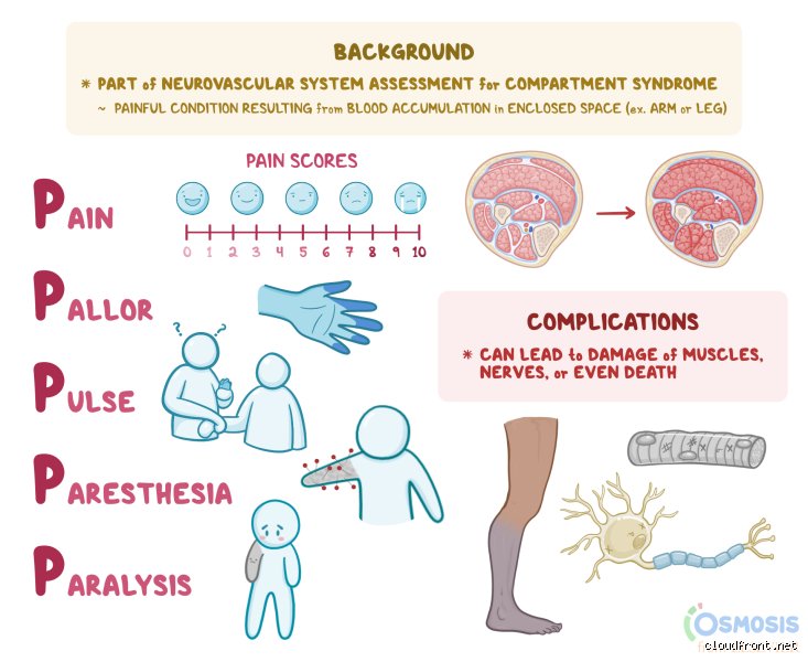 Decoding Clinical Discomfort: Why the 5 P's of Pain Assessment Remain a Nurse’s Ultimate Diagnostic Weapon