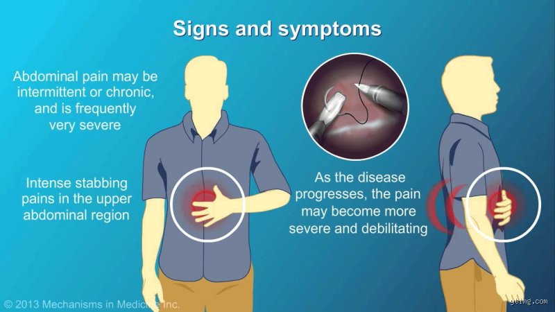 Decoding the Agony: Where Would It Hurt If You Had Pancreatitis and How to Identify the Pain?