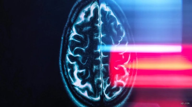 Can a Brain Aneurysm Affect Your Personality? The Hidden Neurological Shifts Patients and Families Rarely See Coming