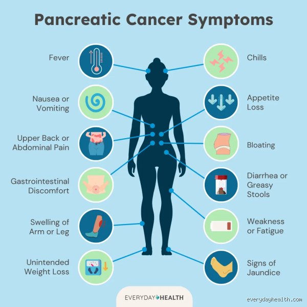 The Great Masquerade: Can Anything Mimic Pancreatic Cancer and Fool the Best Doctors?