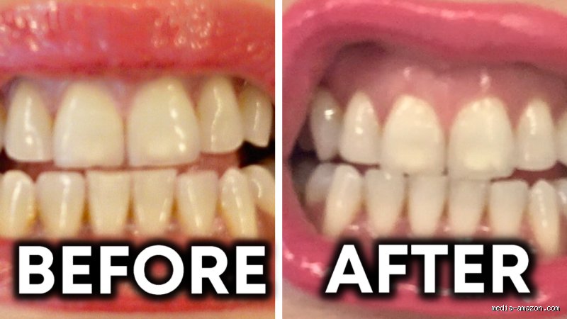 How Long Does It Take to See Results from Baking Soda? The Truth About Timelines and Real Expectations