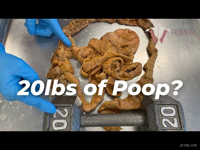How many pounds of poop can a colon hold?