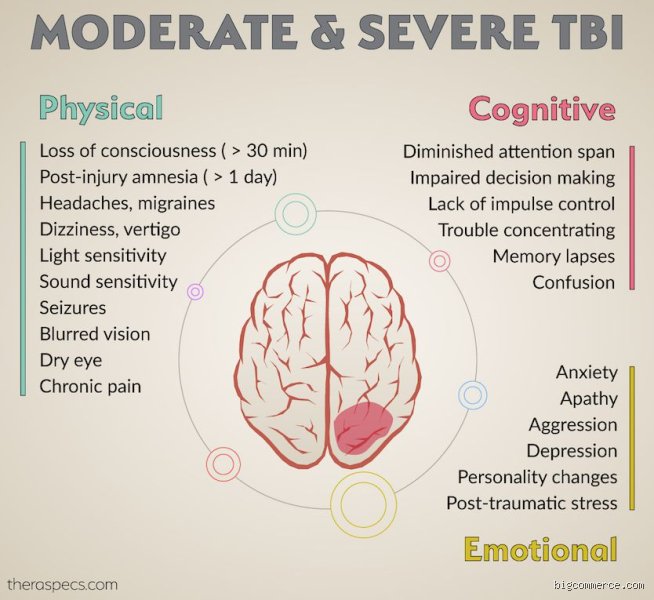 Beyond the Concussion: Hidden Signs That Your Brain Is Damaged and How to Spot Them
