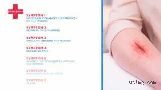 Beyond the Band-Aid: Recognizing the 7 Signs of Infection Before Your Body Sounds the Alarm