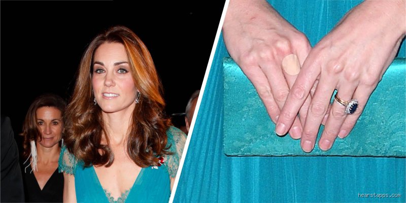 Why Does Kate Always Have Bandaids on Her Fingers? The Mystery Behind the Princess of Wales’s Hands