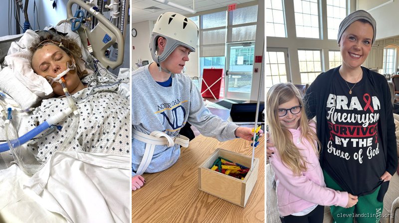 Surviving the Ticking Time Bomb: Has Anyone Ever Survived a Brain Aneurysm and What Does Recovery Actually Look Like?