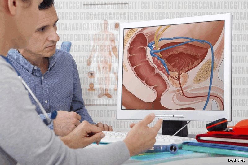 Is It Worth Having Prostate Surgery? The Hidden Trade-offs and Hard Truths Patients Are Rarely Told