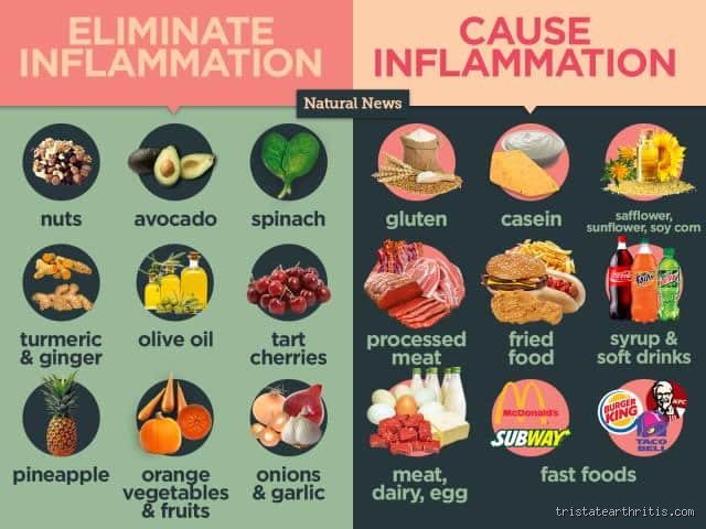 The Inflammatory Plate: Which Foods Aggravate Arthritis and Trigger Chronic Joint Pain?