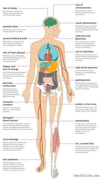 The Silent Destruction: Which Organ Is Most Affected by Diabetes?