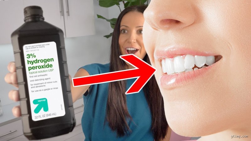 Can I Use Straight Hydrogen Peroxide to Whiten My Teeth Safely at Home?