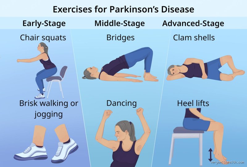 Moving Against the Freeze: What is the Best Exercise for Parkinson's Disease to Rewrite Your Brain's Future?