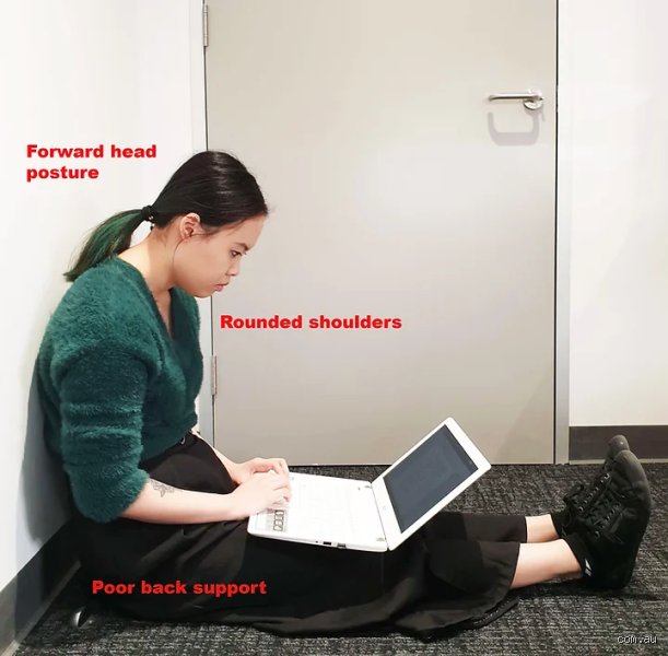 Can laptops cause leg pain?
