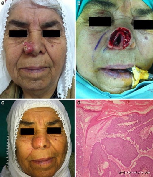 What Does Aqua Regia Do to Humans When Catastrophic Exposure Occurs in the Laboratory