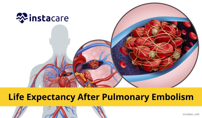 Does Pulmonary Embolism Shorten Life Expectancy? The Raw Truth About Survival and Long-Term Survival Metrics