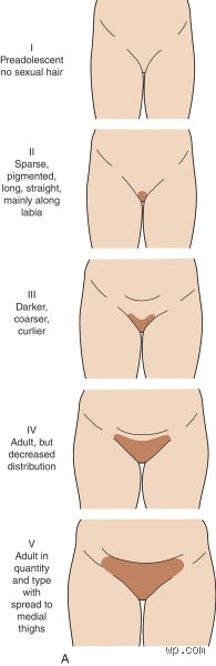Is 7 Too Early for Pubic Hair? Understanding Premature Adrenarche and Early Childhood Development