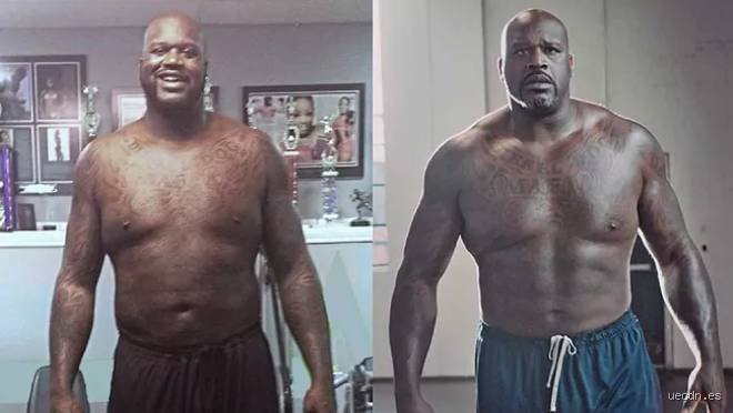 The Truth Behind the Rumors: What Syndrome Does Shaq Have and How Does It Affect the NBA Legend?