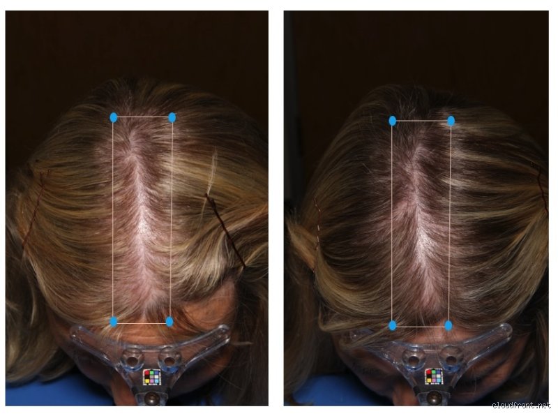 What Race Has the Most Damaged Hair? The Surprising Molecular Truth Behind Ethnic Hair Care