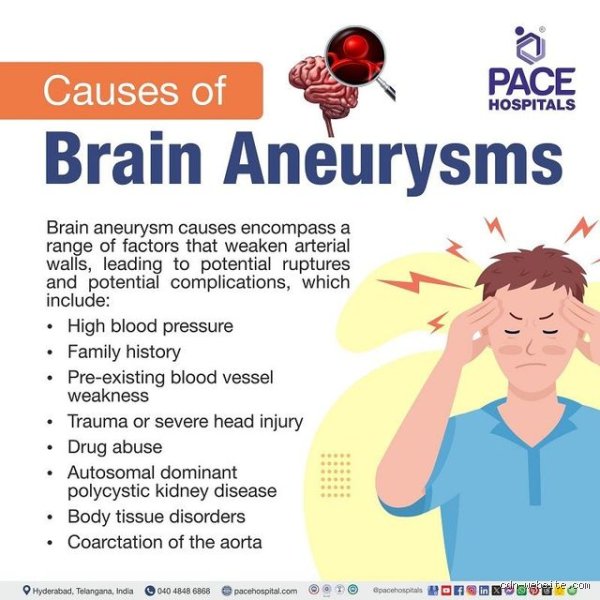 Can Lack of Sleep Cause an Aneurysm? Unpacking the Hidden Neurological Toll of Chronic Restlessness