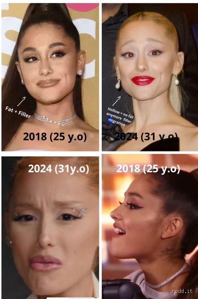 The Real Reason Why Ariana Grande Move Her Jaw So Much During Her Live Vocal Performances