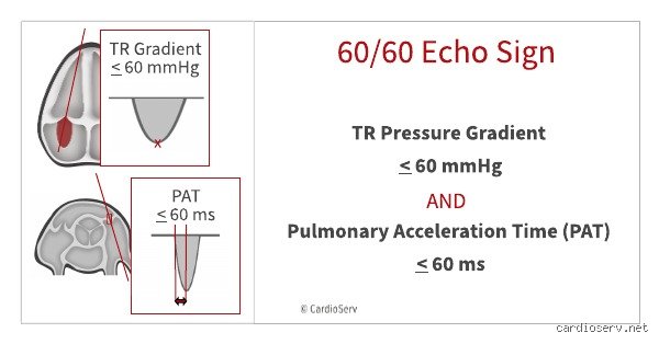 Cracking the Clinical Code: What is the Rule of 60 in Pulmonary Embolism and Why It Matters in the ER