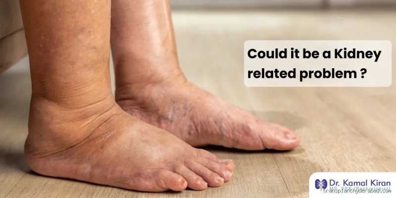 What stage of kidney disease is swollen feet?