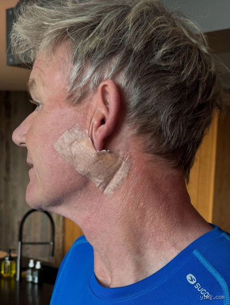 Behind the Kitchen Nightmares: What Has Gordon Ramsay Been Diagnosed With Over His Career?
