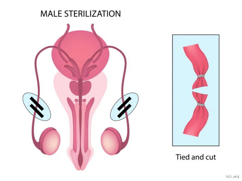 Is it easier for a man or woman to be sterilized when navigating modern healthcare systems?