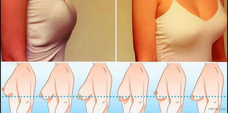 The Great Braless Debate: Will Breasts Get Saggy After Not Wearing a Bra or Is It Myth?