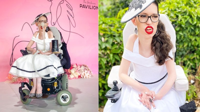 Decoding the Rumors and Reality: What is Taylor Swift’s Disability and How Does She Navigate the Public Eye?