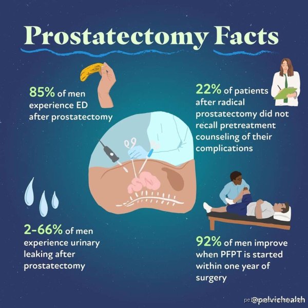 Navigating the Hidden Costs and Long-Term Realities: What Is the Downside of Prostate Surgery?