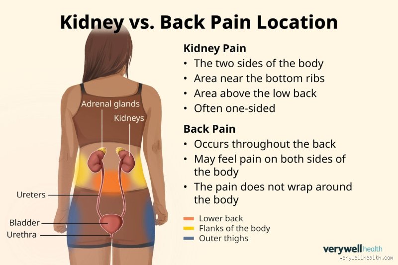 What part of your body hurts when your kidneys are failing?
