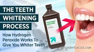 The Science of Brighter Smiles: How Much Hydrogen Peroxide Is Best for Teeth Whitening Without Wrecking Your Enamel?
