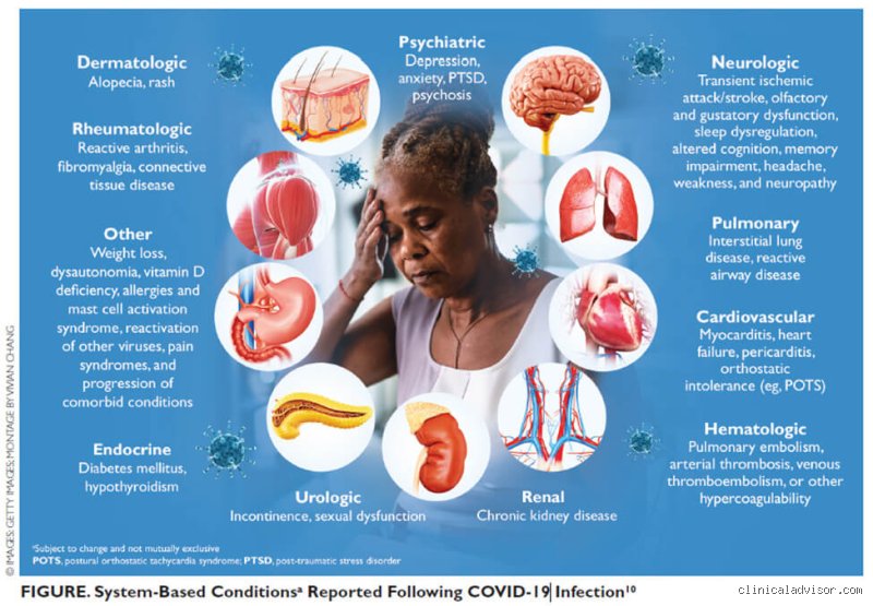 How do they diagnose long COVID?