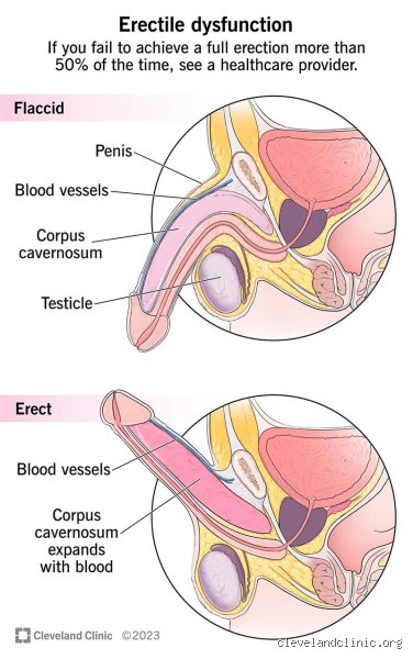 Why Can't I Get 100% Hard? The Unfiltered Biological Truth About Partial Erections
