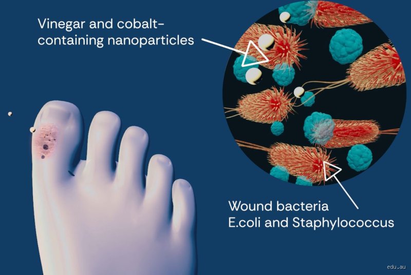 Can vinegar help a bacterial infection or is it just kitchen folklore?